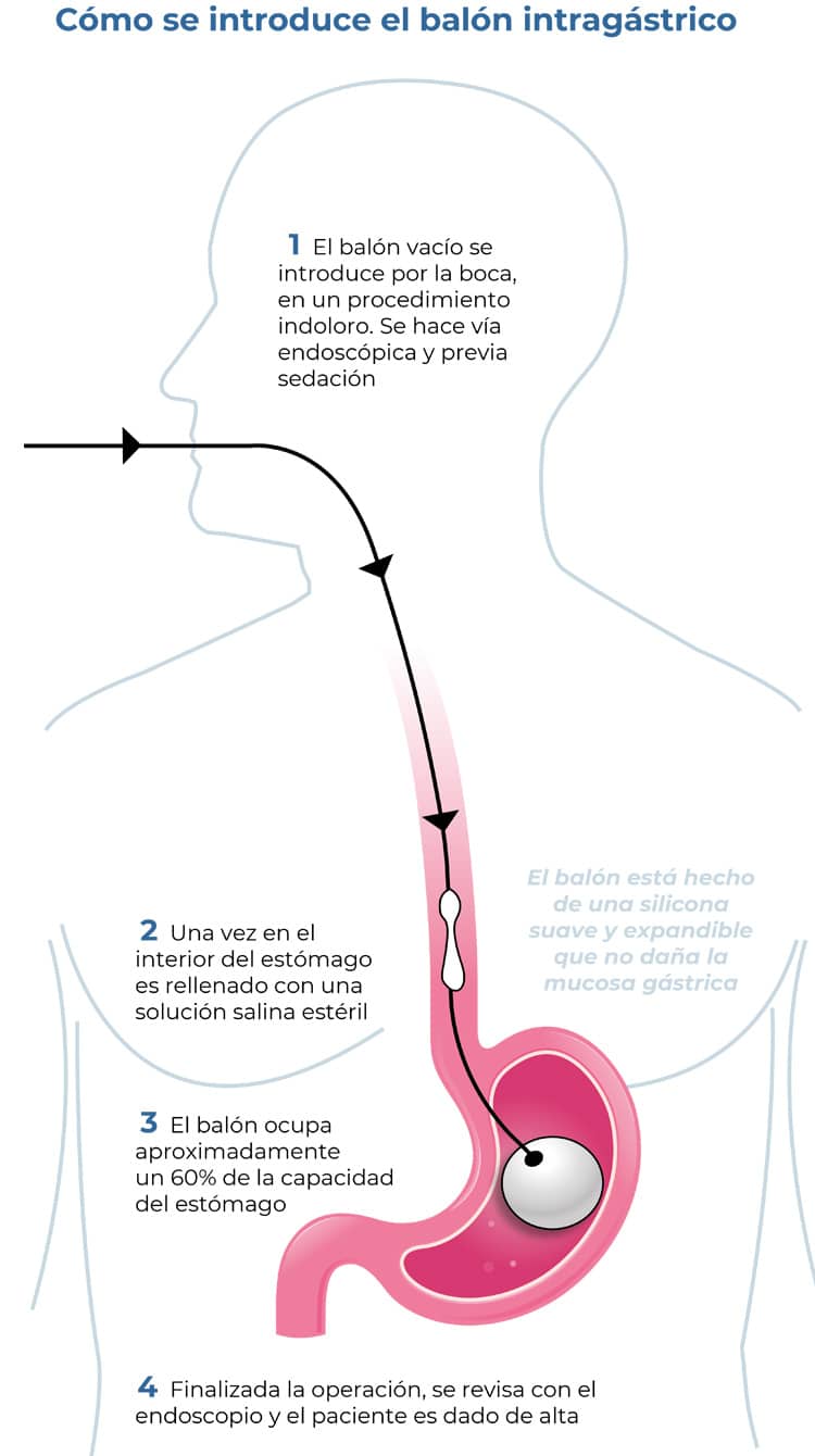 En que consiste la dieta liquida preoperatoria