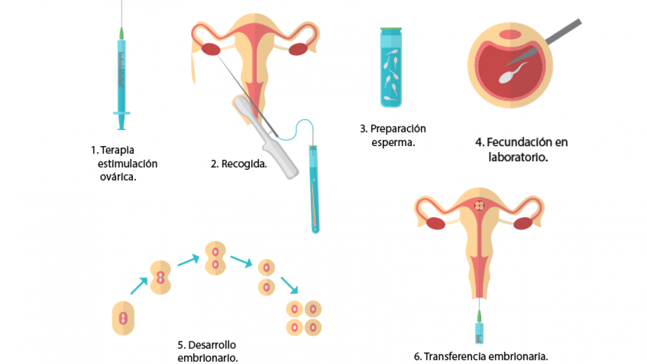 micción frecuente después de la transferencia de óvulos