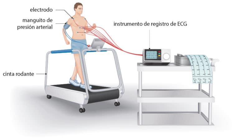 ¿en Qué Consiste Una Prueba De Esfuerzo • Portal De Saludemk 5897