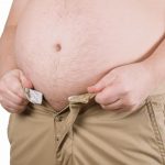 Postoperatorio y recuperación tras reducción de estómago